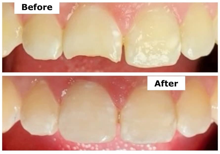 Dental restoration example from the practice website